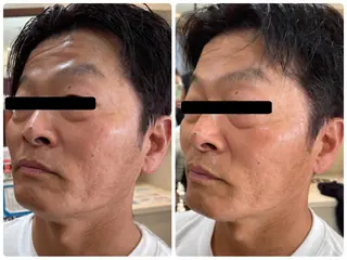 Eyelash Salon 4Uのマツエク・マツパデザイン