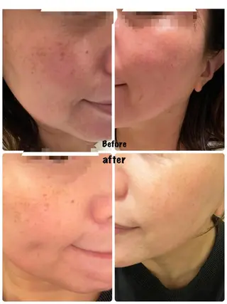 eyelist Asamiのマツエク・マツパデザイン