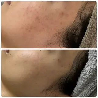 Esthe salon Blanche(エステサロンブランシュ)所属・小顔リフトアップ 美肌改善専門店のエステ・リラクイメージ