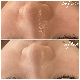 メンズ メナード岐阜茜部 杉浦のエステ・リラクイメージ