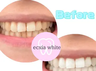 セルフホワイトニングサロン　エクシアホワイト西尾店所属・エクシアホワイト西尾 堀内恵のその他イメージ