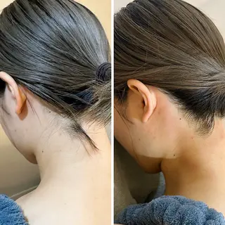 うなじ脱毛/美肌脱毛 LABELのエステ・リラクイメージ