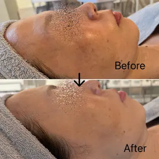 Blue Moon 【ブルームーン】のエステ・リラクイメージ