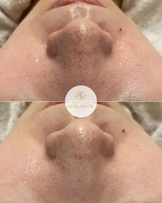 ADEL WEISS 脱毛＆毛穴＆リンパのその他イメージ