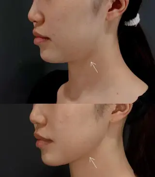 マツエク・マツパ aliaハイフ&水光ジェットサロン所属・aliaハーブ水光店 エステティシャン募集のエステ・リラクイメージ