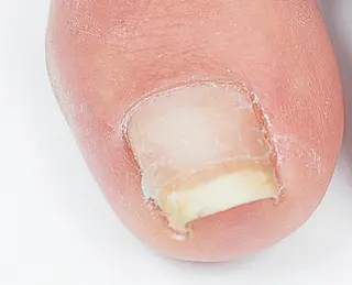 BellaLuna 金子のネイルデザイン