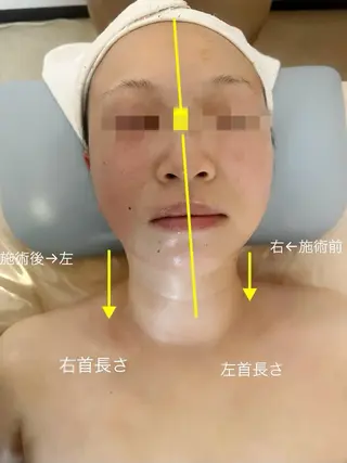 痩身&小顔サロン L i l yA sのエステ・リラクイメージ