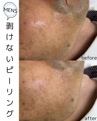 メンズ 歌舞伎町深夜サロン to mëのエステ・リラクイメージ