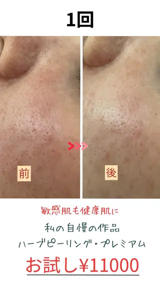 たるみ改善小顔エステ 堀葉月のその他イメージ