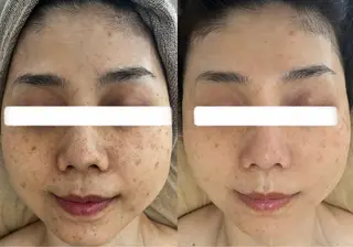 小顔&美肌品川店 Masqueradeのエステ・リラクイメージ