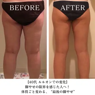 【三軒茶屋/下馬】 本格痩身・よもぎ蒸しのエステ・リラクイメージ