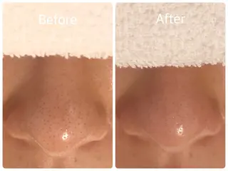 salon HATOのエステ・リラクイメージ