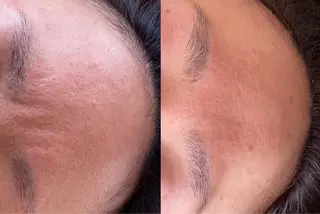 れふぇるん所属・れふぇるん 毛穴洗浄のエステ・リラクイメージ