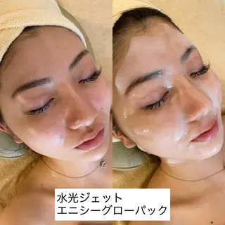 うなじ脱毛/美肌脱毛 LABELのエステ・リラクイメージ