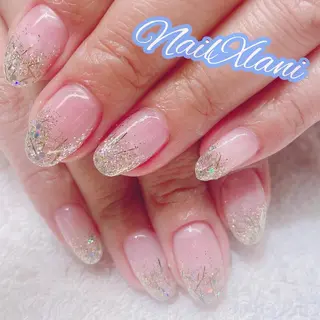 ネイル Nail×Lani 深爪矯正対応◎のネイルデザイン