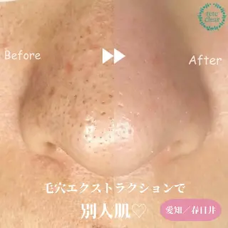 若山 遙子のエステ・リラクイメージ