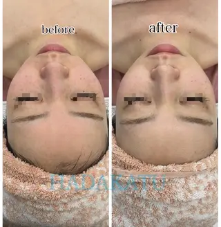 総合エステサロン 肌活のエステ・リラクイメージ