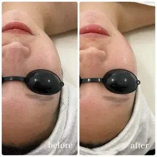 Liam《美肌管理/ 3D小顔/脂肪ケア》のエステ・リラクイメージ