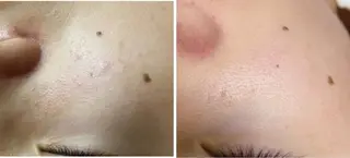 ピーリング専門サロン Spicaのエステ・リラクイメージ