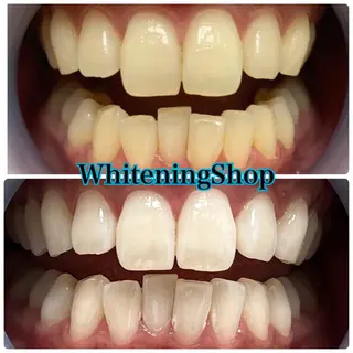 ホワイトニング ショップ吉祥寺店のエステ・リラクイメージ