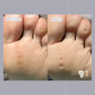 巻き爪補正店 大阪天王寺店のネイルデザイン