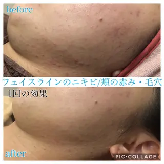 ショート メンズ キッズ ネイル マツエク・マツパ Ensor Clair所属・EnsorClair 代表　野口真央のエステ・リラクイメージ