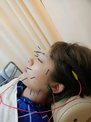 お顔のむくみたるみ 専門☆美容鍼小顔矯正のエステ・リラクイメージ