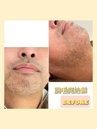 メンズ Reid-月詠-所属・Reid -月詠-のエステ・リラクイメージ