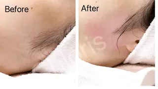 川越ローマピンク 光脱毛＆ワックス脱毛のエステ・リラクイメージ