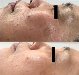 ホワイトニング・ハーブピーリング・フェイシャルサロンSUN所属・SUN MIWAのエステ・リラクイメージ