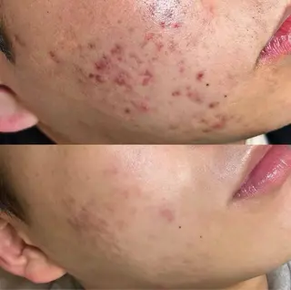 ネイル aliaハイフ&水光ジェットサロン所属・aliaハーブ水光店 エステティシャン募集のエステ・リラクイメージ