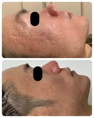 Lussera(ルセラ)所属・肌質を変えて すっぴん肌に✨のその他イメージ