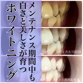 歯のホワイトニング専門店＆white所属・歯のホワイトニング 専門店&whiteのその他イメージ
