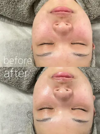 LBSホワイトニング 🌐岡山店のその他イメージ