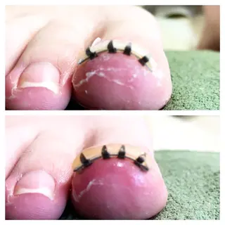 ショート カラー メンズ キッズ ネイル フットケアサロンすりーぴんぐ田端店所属・🌱 ま　し　お　🌱のエステ・リラクイメージ