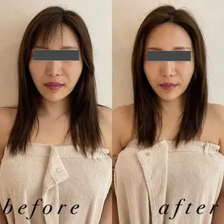 うなじ脱毛/美肌脱毛 LABELのエステ・リラクイメージ