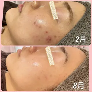 beauty salon LINOBELLE所属・美肌改善専門サロン LINOBELLEのエステ・リラクイメージ