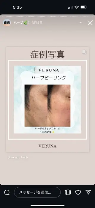 Grandir所属・ハーブピーリング専門 グランディール　武内のエステ・リラクイメージ