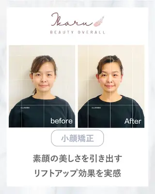 ikaru美容整体 池袋のエステ・リラクイメージ