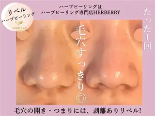 ハーブピーリング専門店HERBERRY難波心斎橋店所属・ハーブピーリング専門 HERBERRY冨永のエステ・リラクイメージ