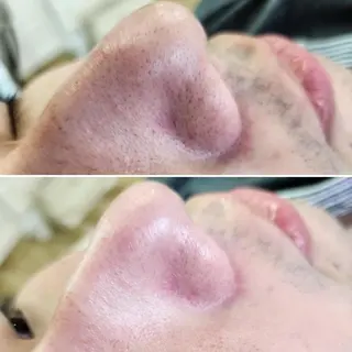 マツエク・マツパ アイブロウ ネイル メンズ Anacia Beauty Salon所属・美肌脱毛&毛穴専門 Anaciaのエステ・リラクイメージ