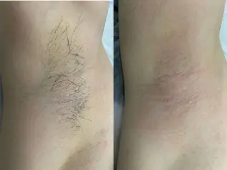 メンズ メンズ美肌脱毛 seekest.のエステ・リラクイメージ