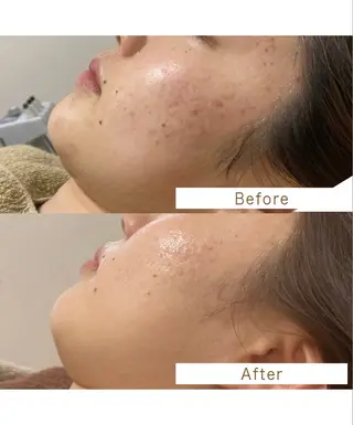 エステサロン .BXのエステ・リラクイメージ