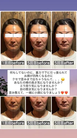 💎後悔させない小顔 矯正💎イトヤマ🌱のエステ・リラクイメージ