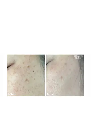 R'well所属・はばすみれ🎀ﾈｲﾙ 光ﾌｪｲｼｬﾙ ﾍｱのネイルデザイン