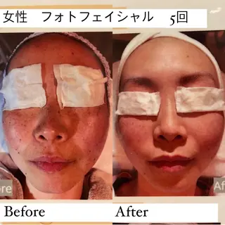 小顔&美肌品川店 Masqueradeのエステ・リラクイメージ