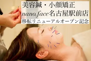 nano.face名古屋駅前店所属・小顔&整体/美容鍼/ nano.faceのエステ・リラクイメージ