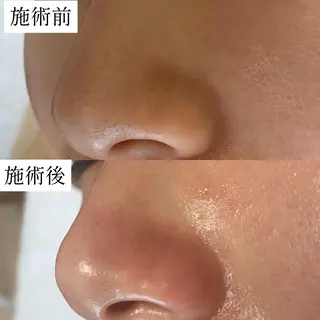 毛穴専門サロン　フルール所属・フルールFululu 自由が丘のエステ・リラクイメージ