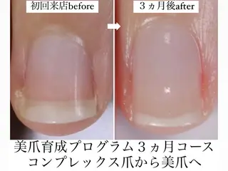 メンズ ネイル 深爪矯正専門店　ネイルサロン　トイロ所属・ネイルサロン トイロのネイルデザイン