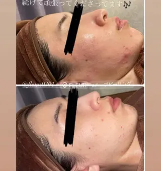 FLEUR🫧 フェイシャルのエステ・リラクイメージ